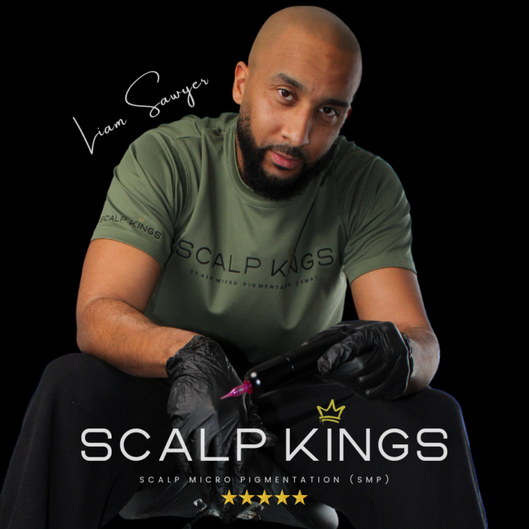 About Scalp Kings - Your Scalp Micropigmentation Clinic in Bristol