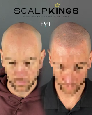 Instagram post from scalpkings. This post is in position 24.