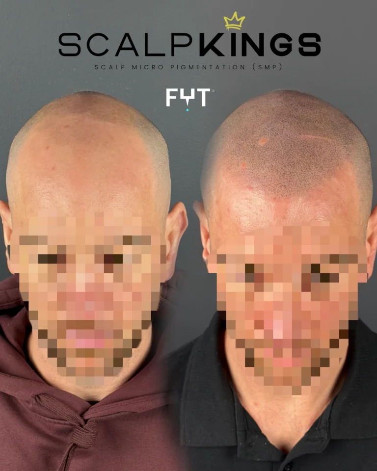 Instagram post from scalpkings. This post is in position 8.