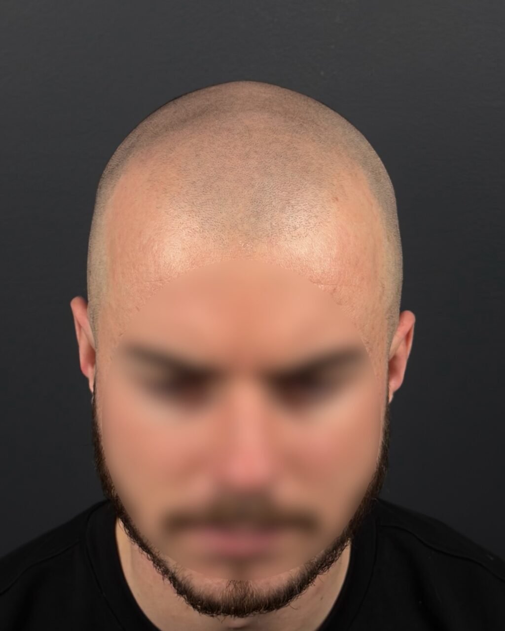 Instagram post from scalpkings. This post is in position 1.