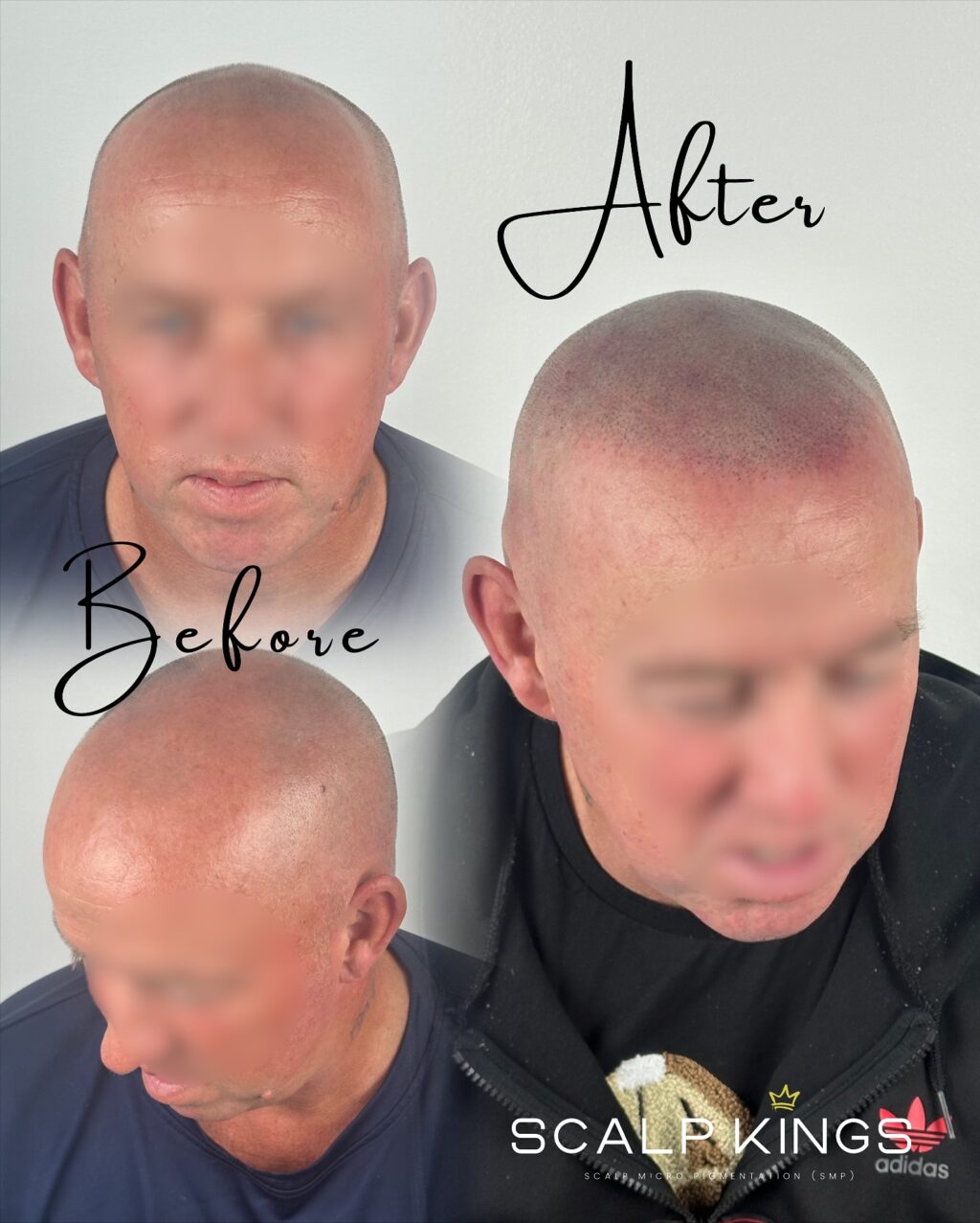 Instagram post from scalpkings. This post is in position 4.