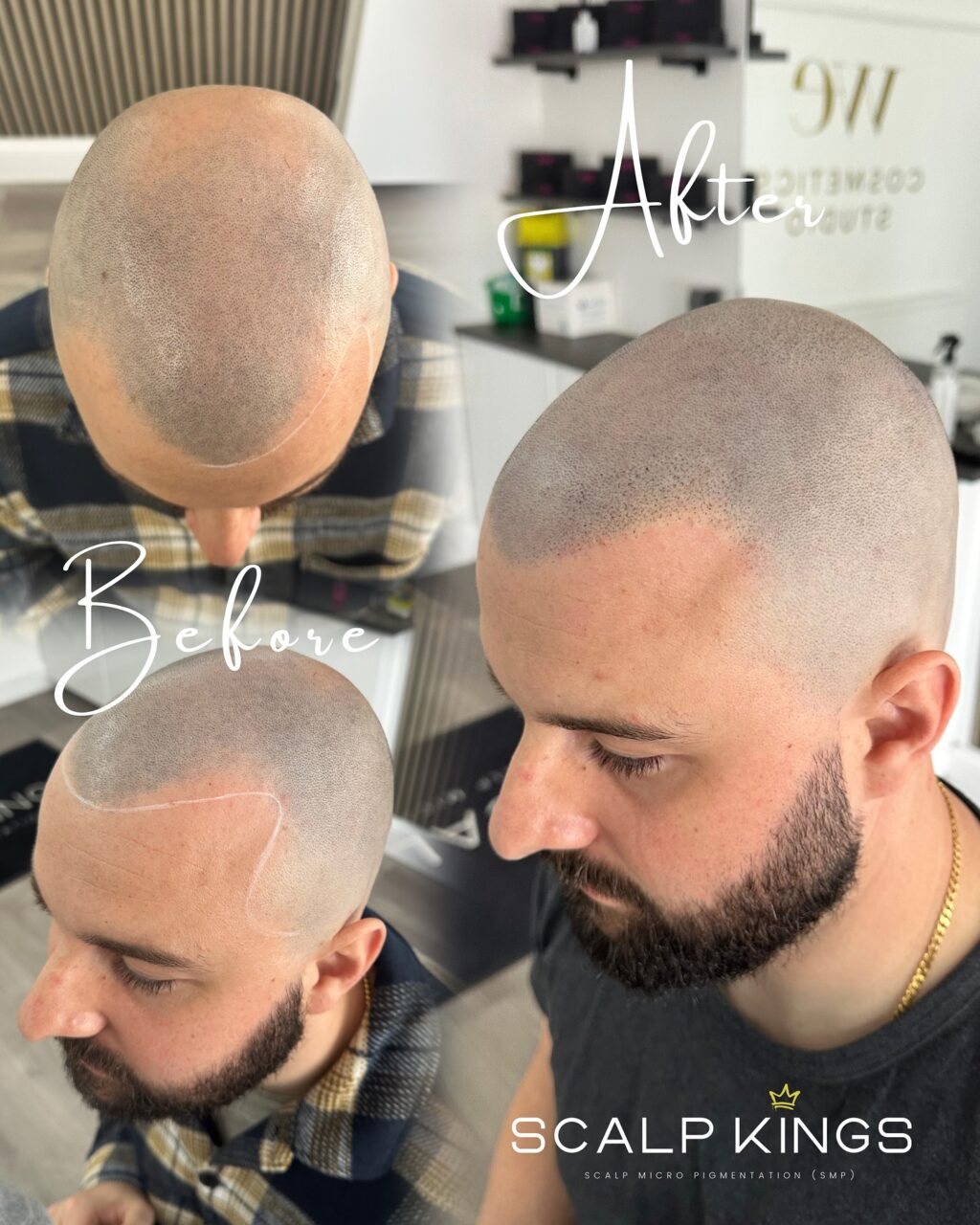 Instagram post from scalpkings. This post is in position 4.