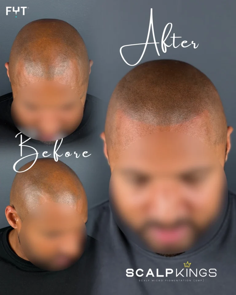 Instagram post from scalpkings. This post is in position 1.