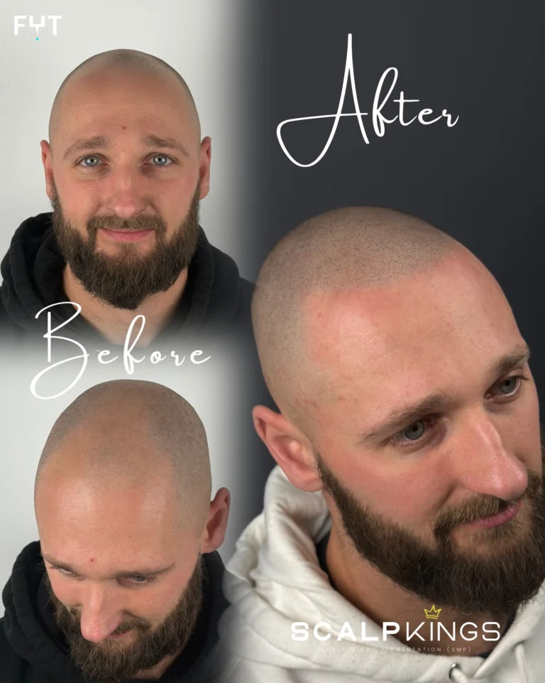 Instagram post from scalpkings. This post is in position 12.