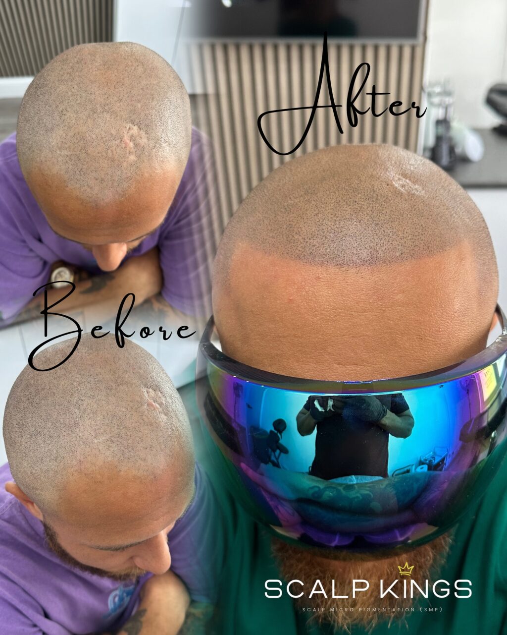 Instagram post from scalpkings. This post is in position 9.