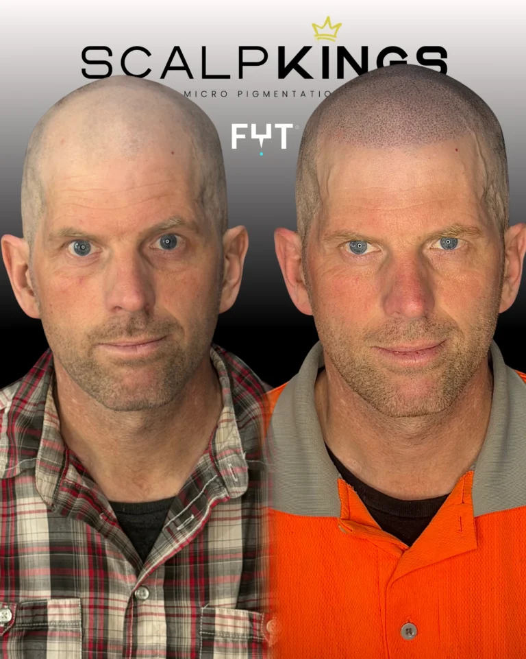 Instagram post from scalpkings. This post is in position 0.