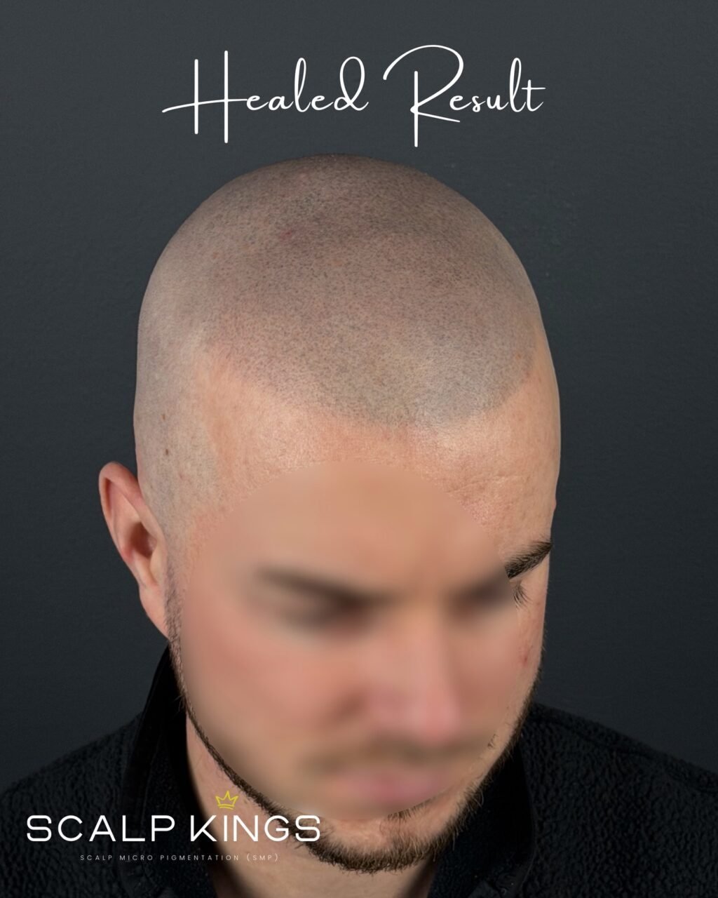 Instagram post from scalpkings. This post is in position 1.