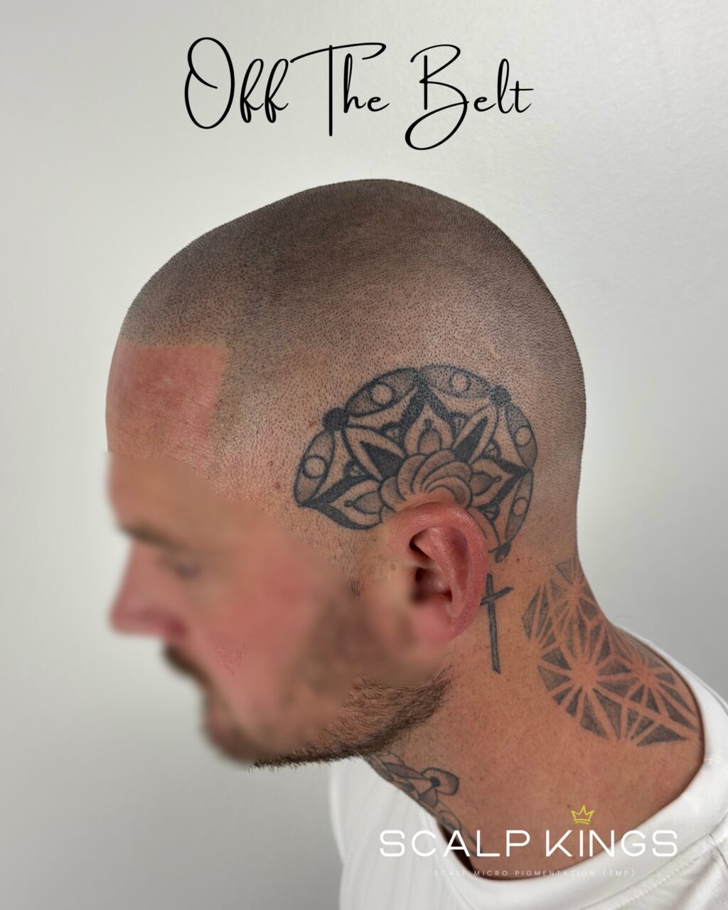 Instagram post from scalpkings. This post is in position 6.