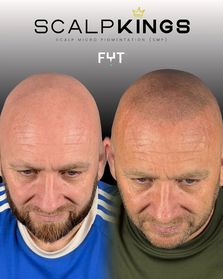 Instagram post from scalpkings. This post is in position 2.