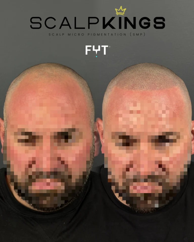 Instagram post from scalpkings. This post is in position 7.