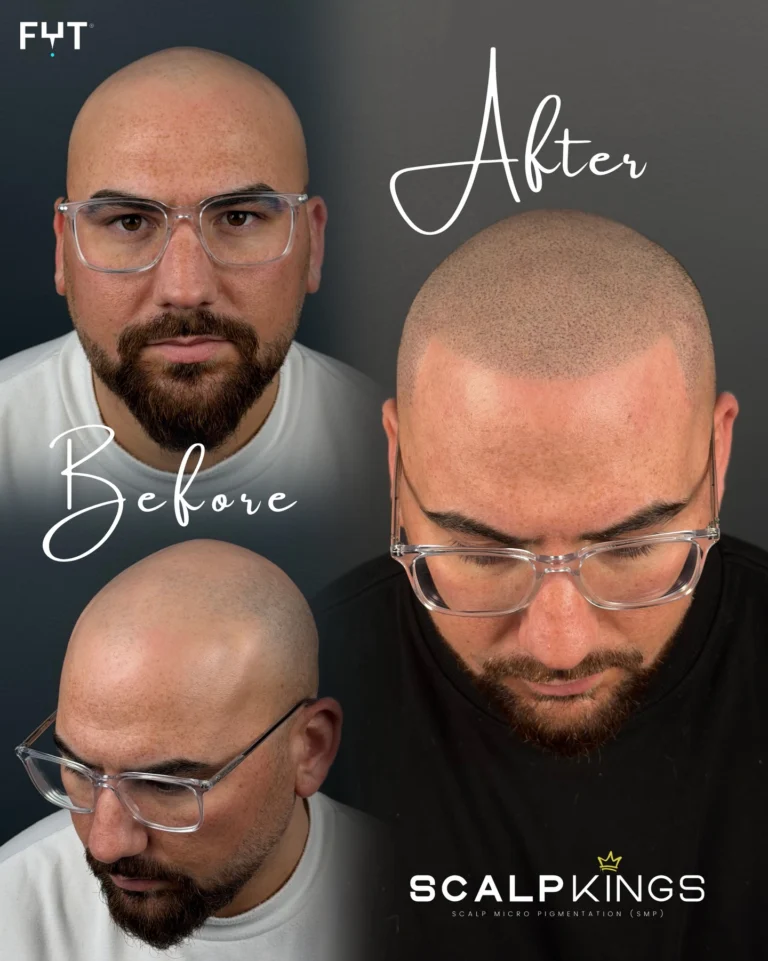 Instagram post from scalpkings. This post is in position 11.