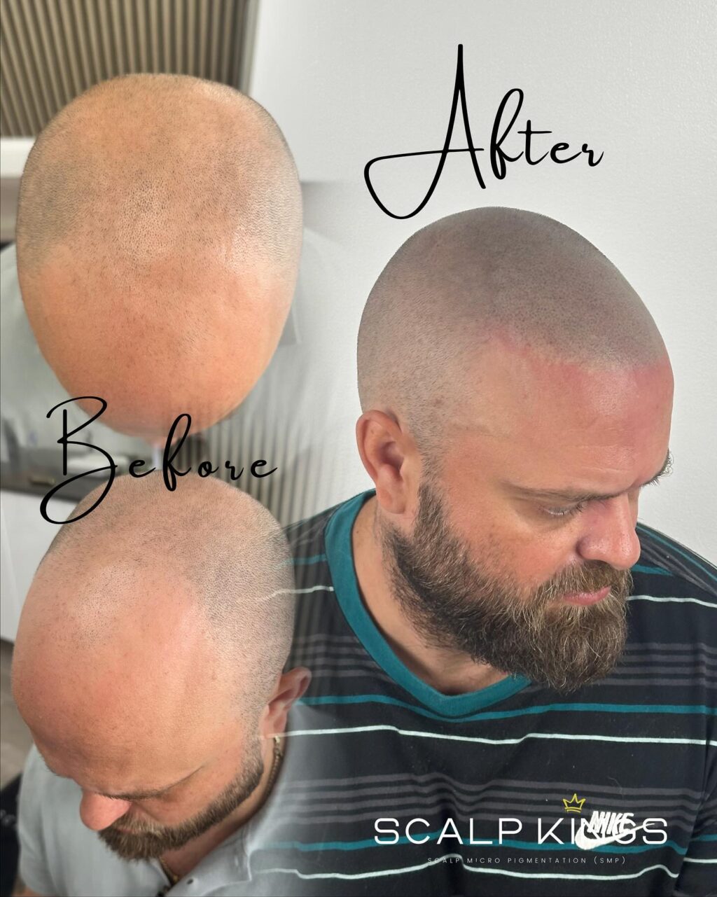 Instagram post from scalpkings. This post is in position 1.