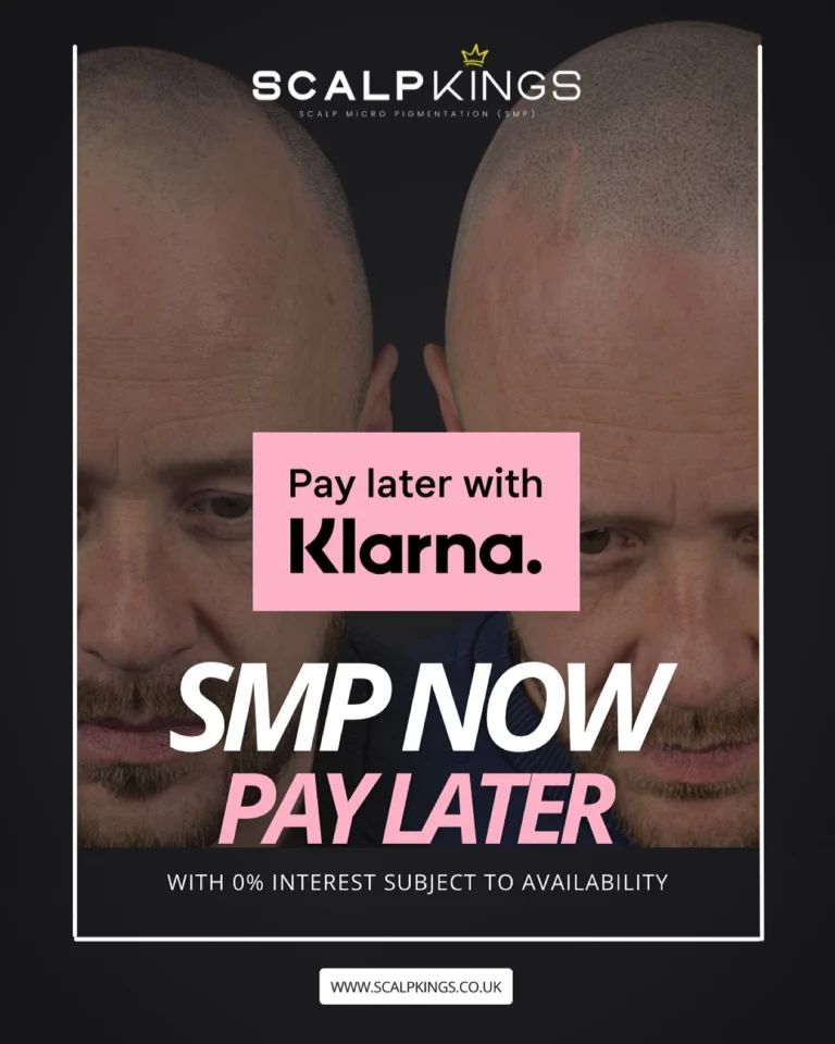 Instagram post from scalpkings. This post is in position 1.