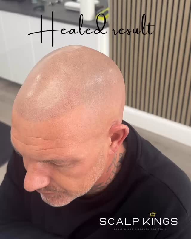 Instagram post from scalpkings. This post is in position 5.