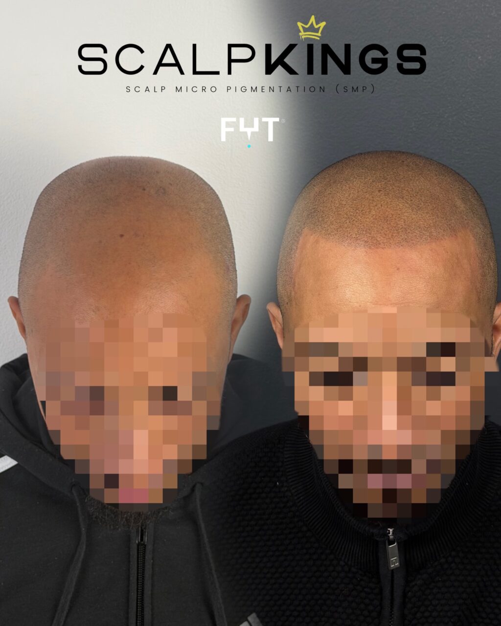 Instagram post from scalpkings. This post is in position 2.