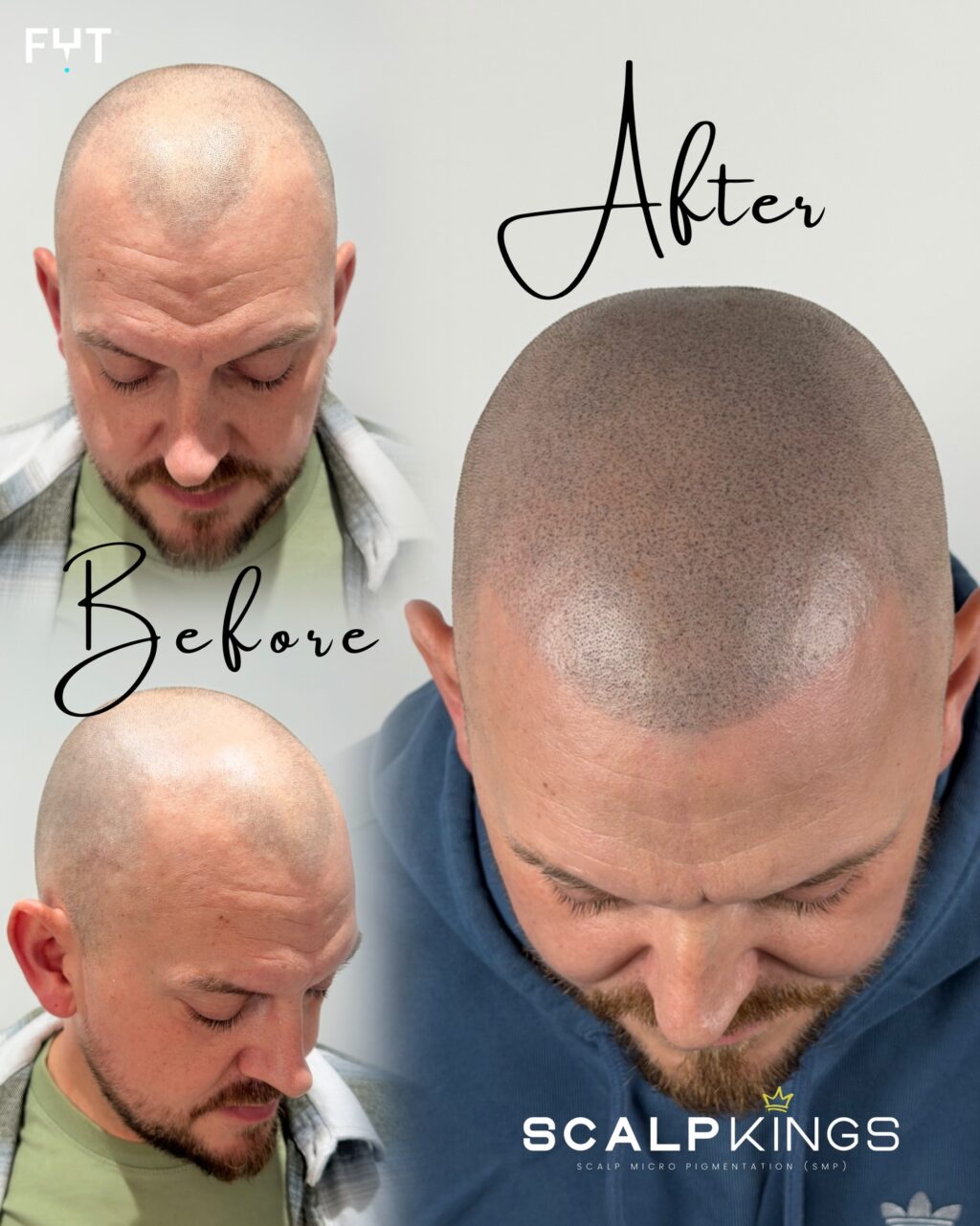 Instagram post from scalpkings. This post is in position 14.