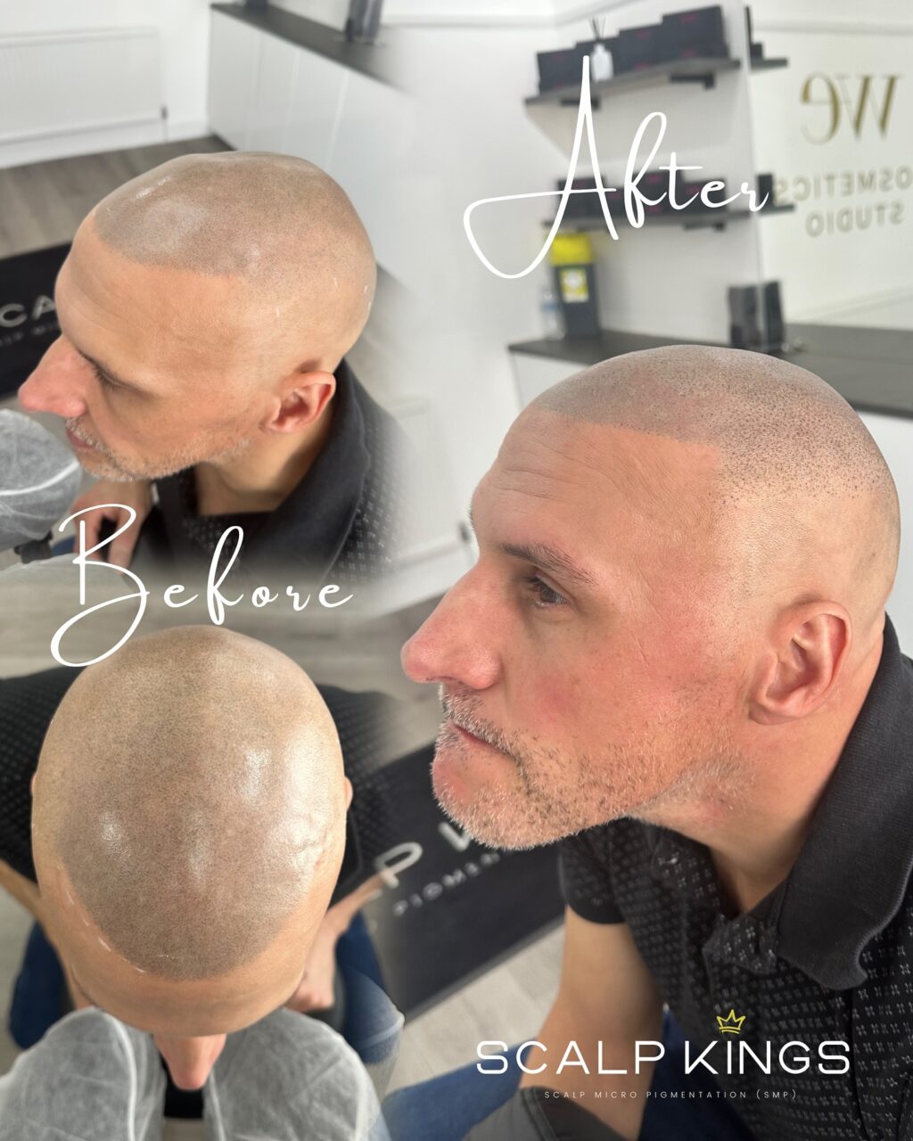 Instagram post from scalpkings. This post is in position 7.