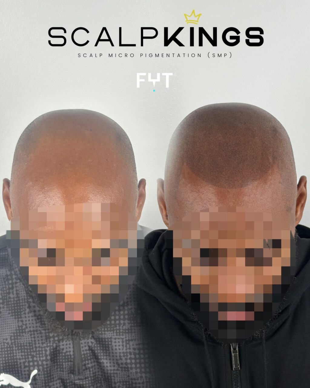 Instagram post from scalpkings. This post is in position 15.