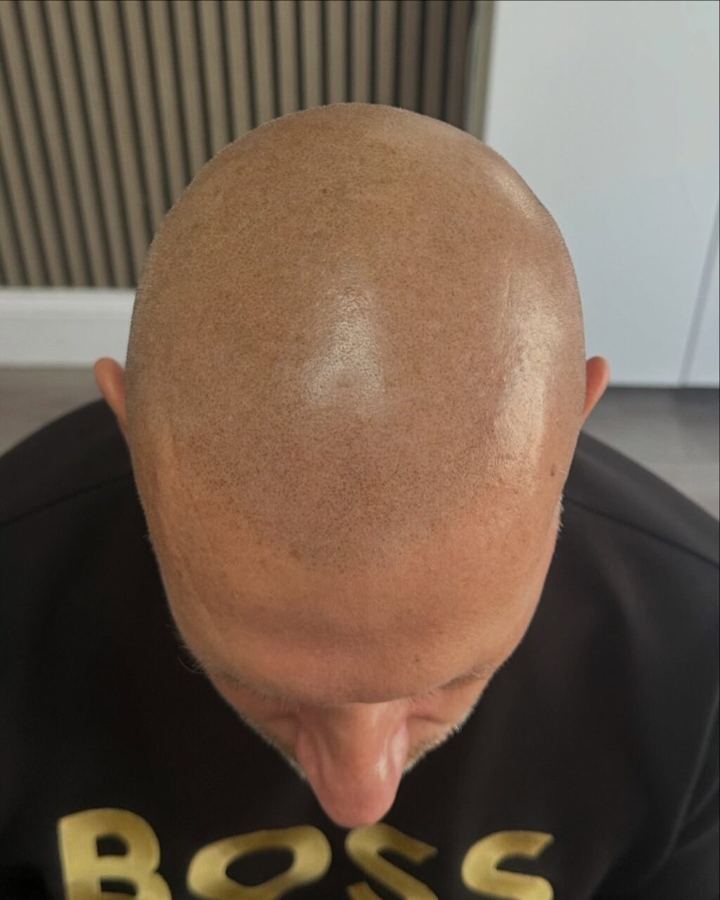 Instagram post from scalpkings. This post is in position 1.