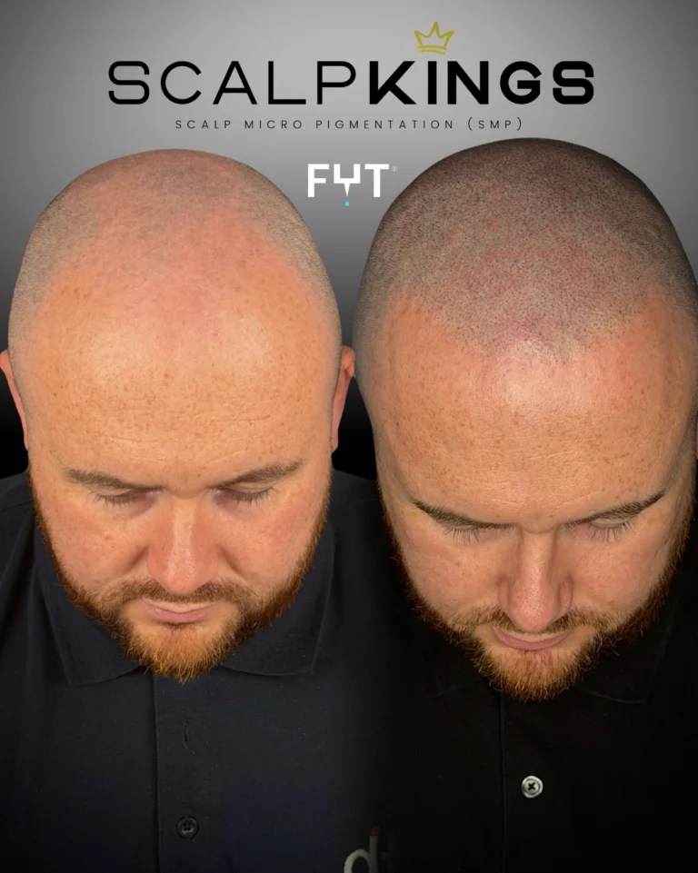 Instagram post from scalpkings. This post is in position 3.