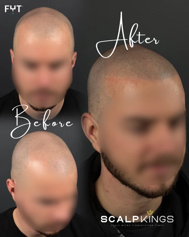 Instagram post from scalpkings. This post is in position 14.