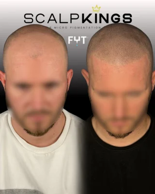 Instagram post from scalpkings. This post is in position 3.