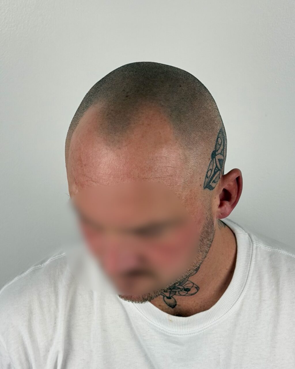 Instagram post from scalpkings. This post is in position 1.