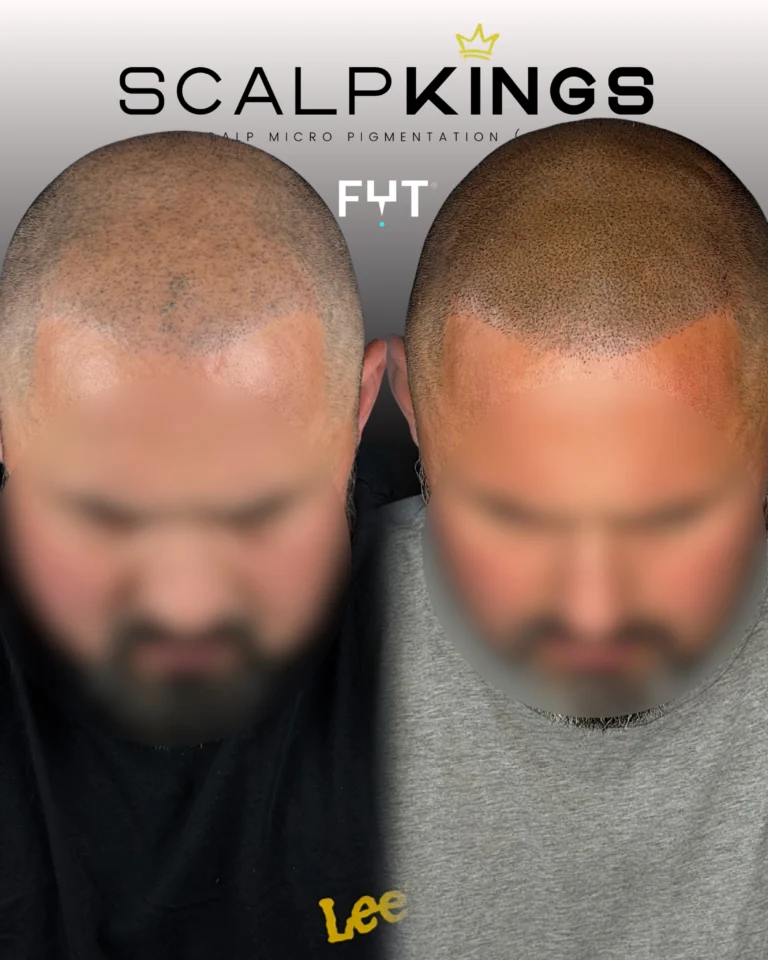 Instagram post from scalpkings. This post is in position 1.