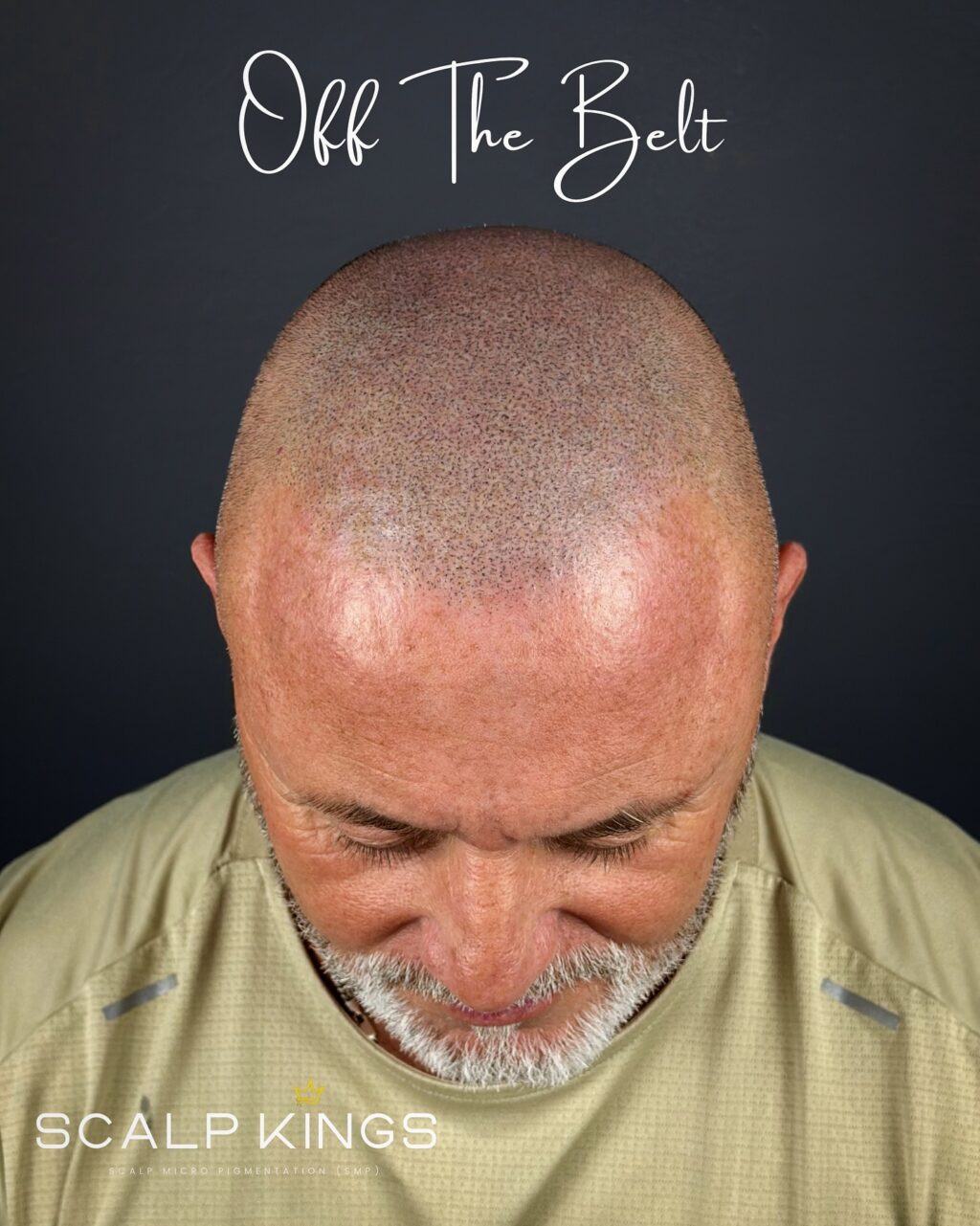 Instagram post from scalpkings. This post is in position 2.