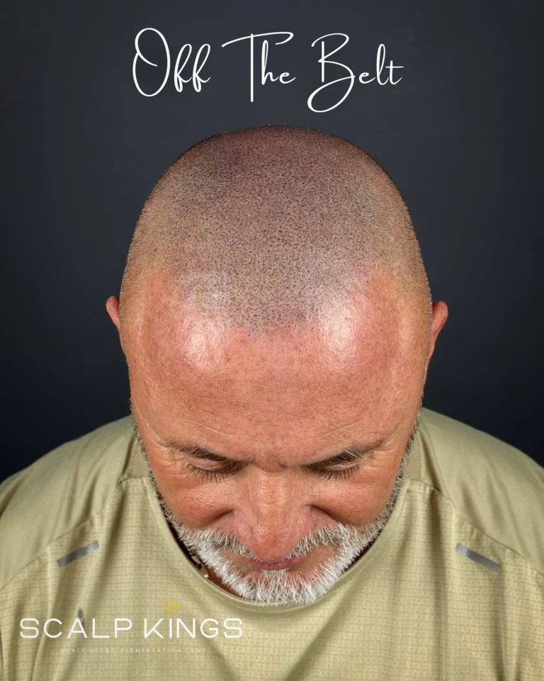 Instagram post from scalpkings. This post is in position 3.