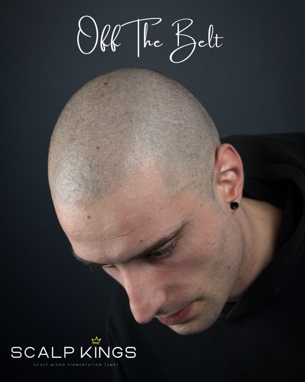 Instagram post from scalpkings. This post is in position 1.