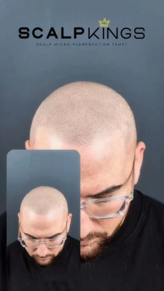 Instagram post from scalpkings. This post is in position 18.