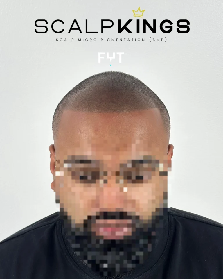 Instagram post from scalpkings. This post is in position 15.