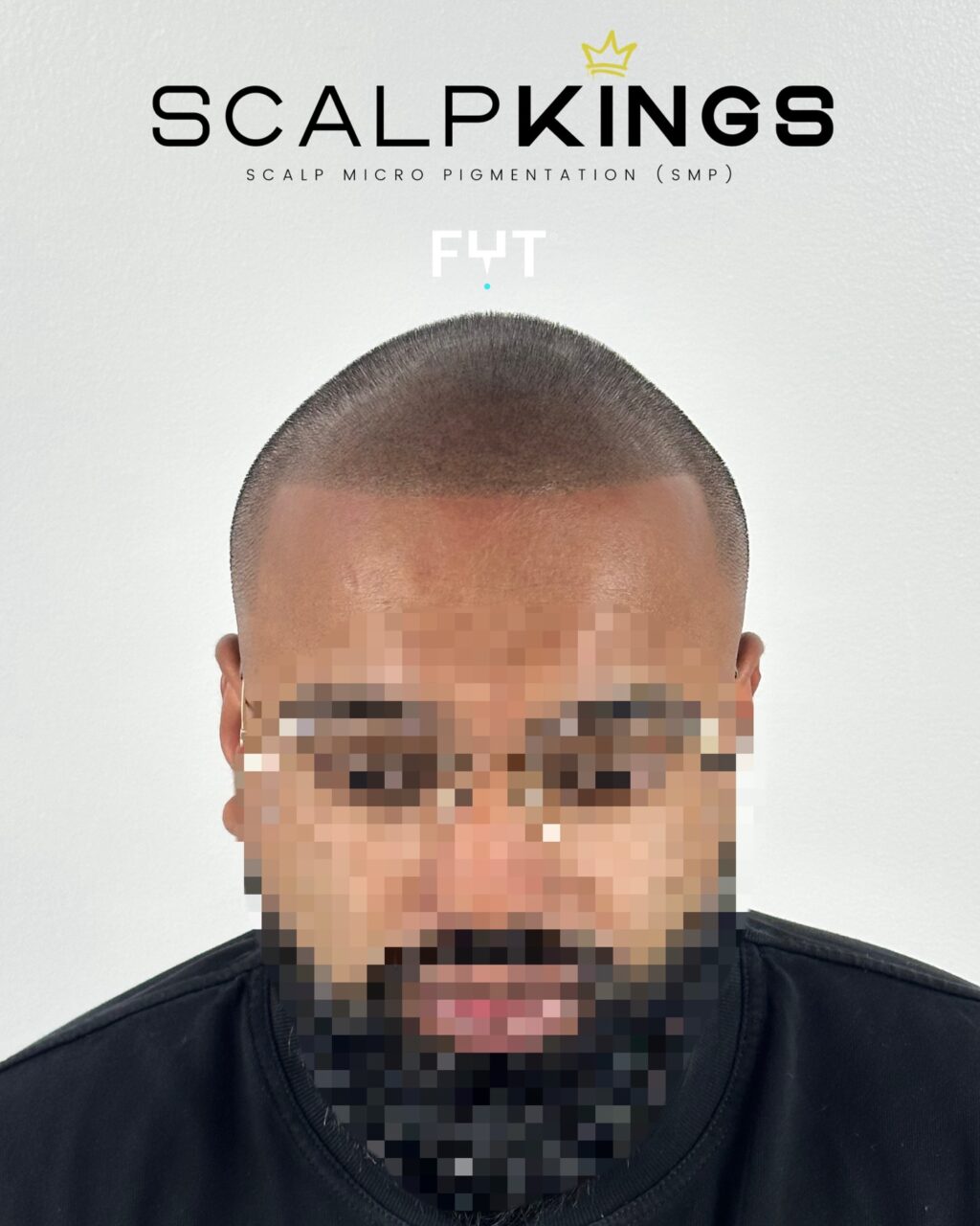 Instagram post from scalpkings. This post is in position 0.