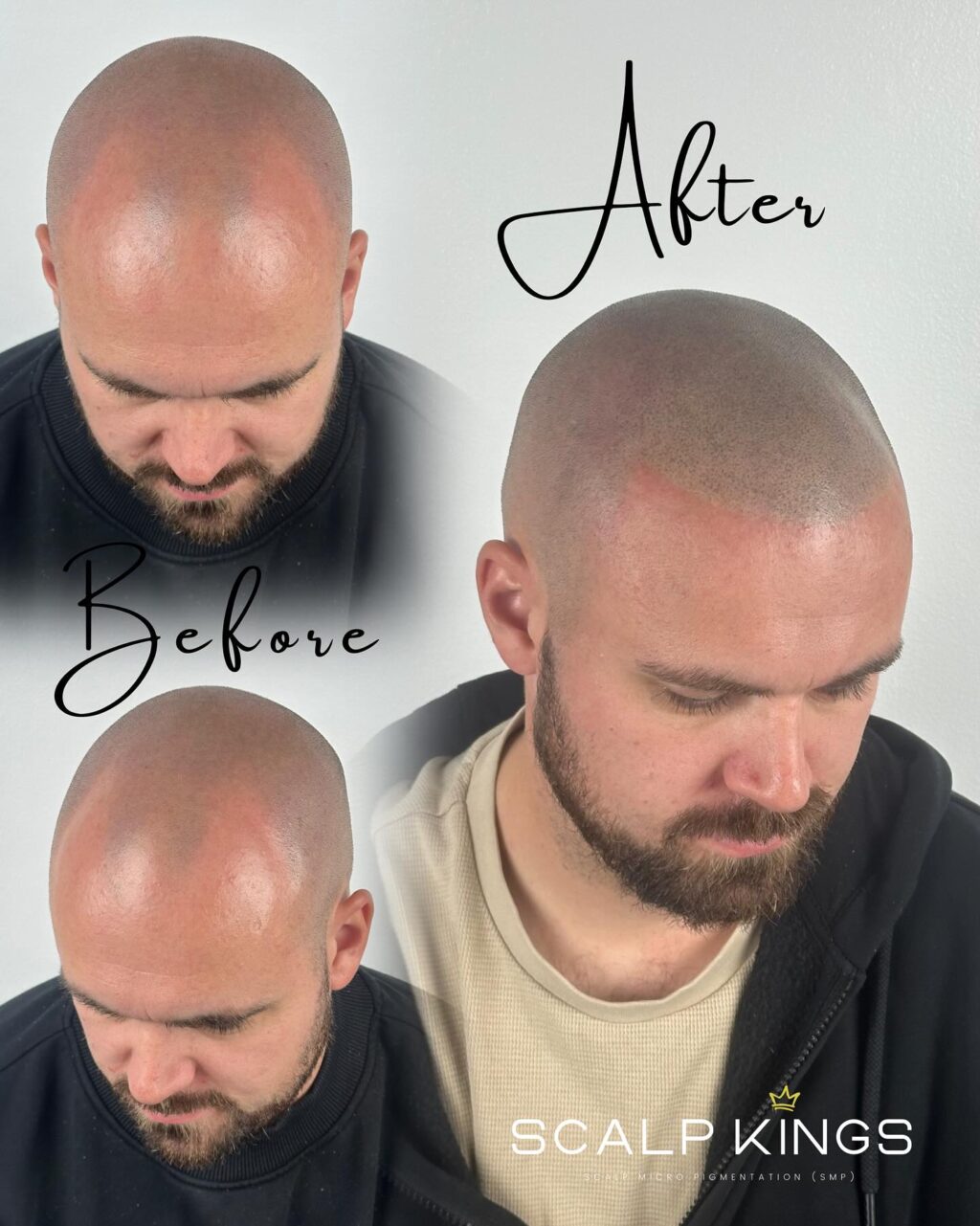 Instagram post from scalpkings. This post is in position 1.