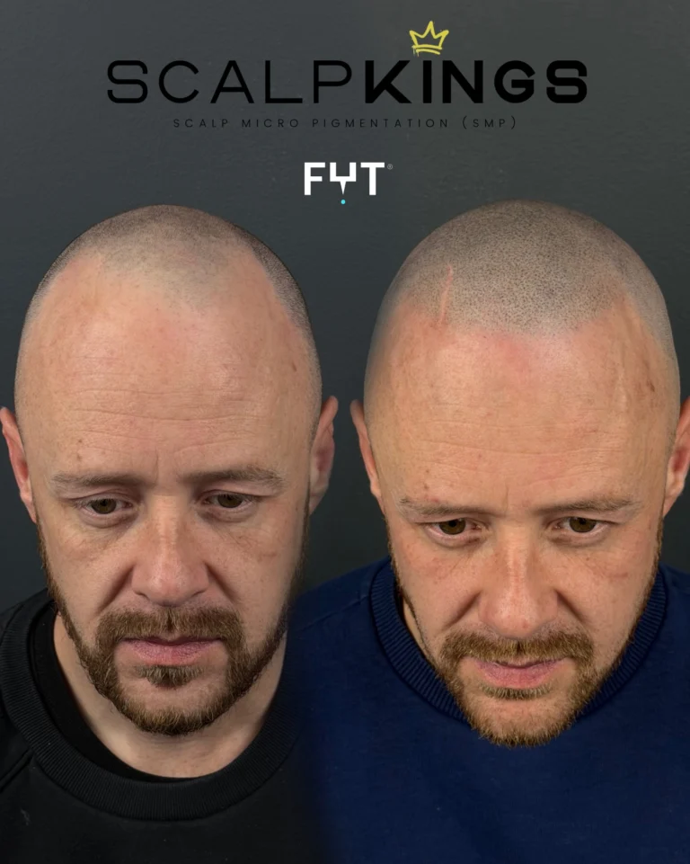 Instagram post from scalpkings. This post is in position 10.