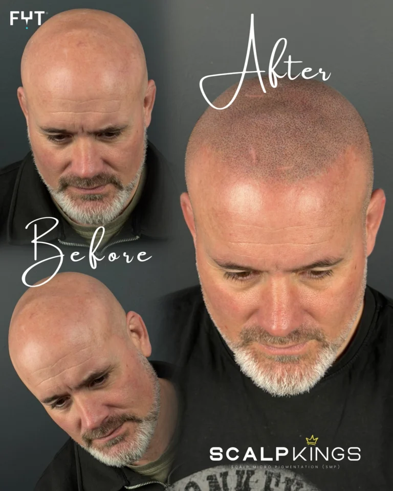 Instagram post from scalpkings. This post is in position 3.