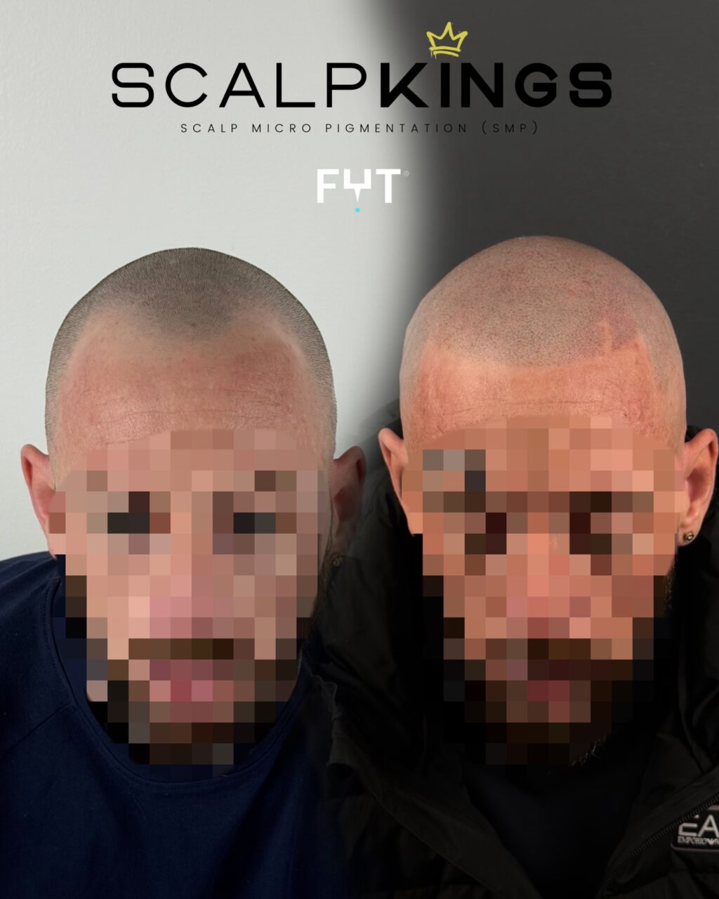 Instagram post from scalpkings. This post is in position 1.