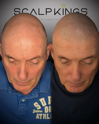 Instagram post from scalpkings. This post is in position 1.
