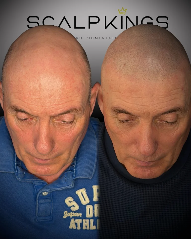 Instagram post from scalpkings. This post is in position 0.