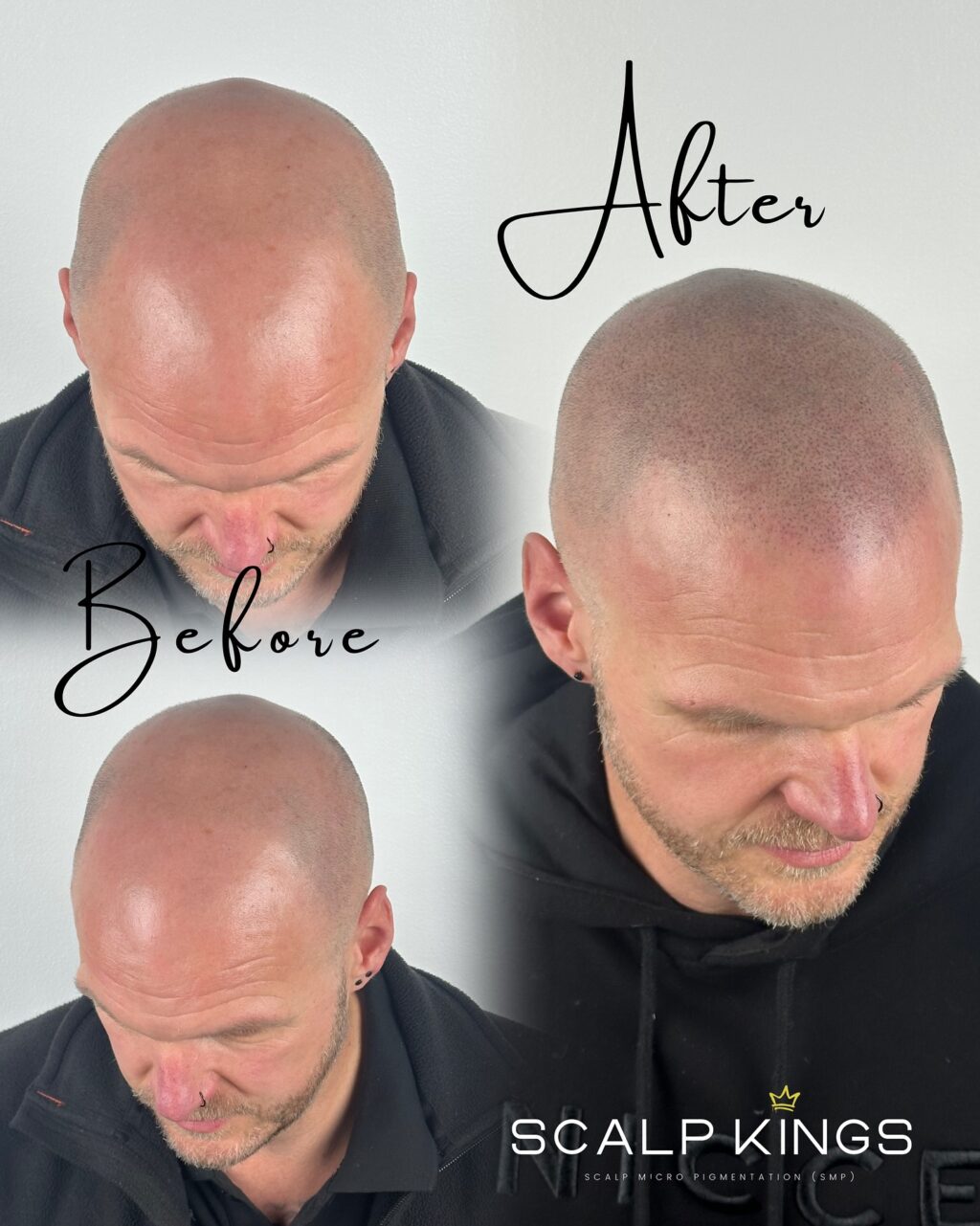 Instagram post from scalpkings. This post is in position 1.