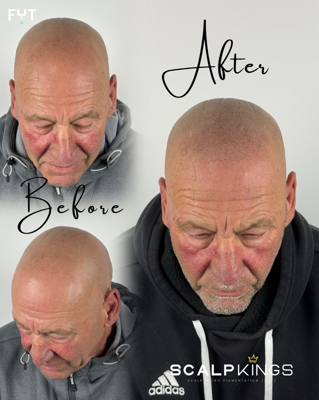 Instagram post from scalpkings. This post is in position 7.